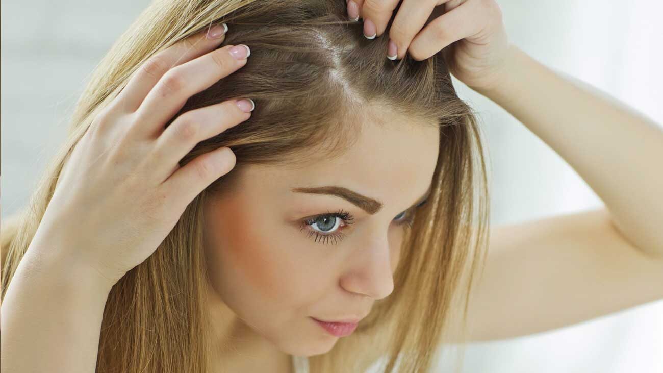 caida cabello