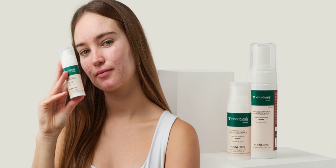 Trnd busca 200 probadores para Vincobiosis Acneic la línea facial pensada para piel con tendencia acneica